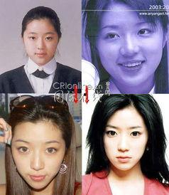 韩 明星 整容 失败,美丽代价与反思”